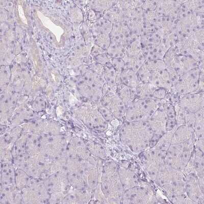 Immunohistochemistry-Paraffin: CTNNA3 Antibody [NBP2-49348]