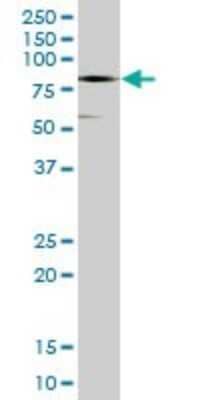 Western Blot: CTNNA3 Antibody [H00029119-B01P]