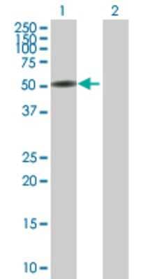 Western Blot: CTNNA3 Antibody [H00029119-B01P]