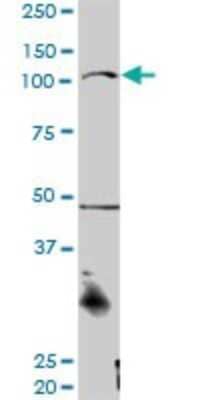 Western Blot: CTNNA3 Antibody [H00029119-D01P]