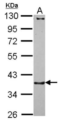 Western Blot: CTNNA3 Antibody [NBP2-16030]