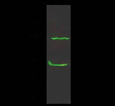 Western Blot: CTNNA3 Antibody [NBP2-99083]