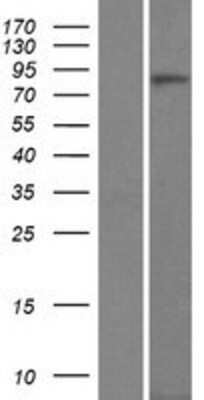 Western Blot: CTNNA3 Overexpression Lysate [NBP2-07428]