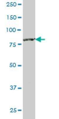 Western Blot: CTNNAL1 Antibody (2C11) [H00008727-M05]