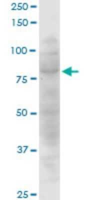 Western Blot: CTNNAL1 Antibody (3C8) [H00008727-M08]