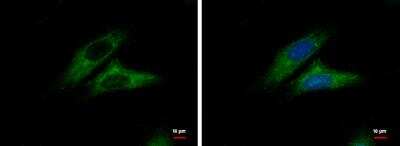 Immunocytochemistry/ Immunofluorescence: CTNNAL1 Antibody [NBP1-33341]