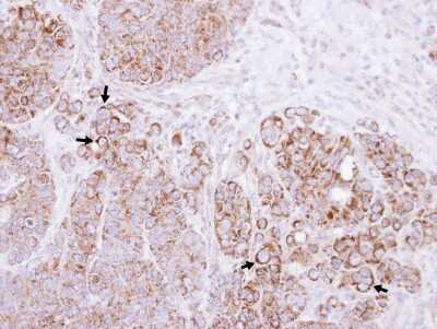 Immunohistochemistry-Paraffin: CTNNAL1 Antibody [NBP1-33341]