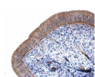 Immunohistochemistry-Paraffin: CTNNAL1 Antibody [NBP1-33341]