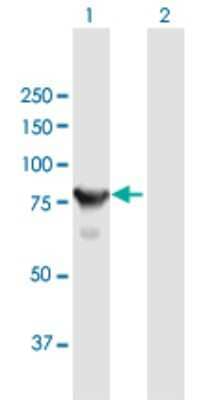 Western Blot: CTNNAL1 Antibody [H00008727-B01P]