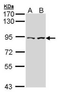 Western Blot: CTNNAL1 Antibody [NBP1-33341]