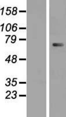 Western Blot: CTNNAL1 Overexpression Lysate [NBP2-07952]