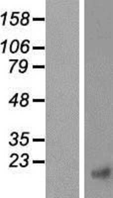 Western Blot: ICAT/CTNNBIP1 Overexpression Lysate [NBP2-06663]