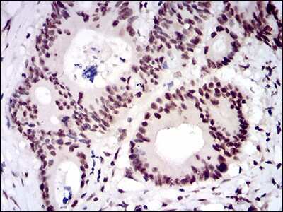 Immunohistochemistry: CTNNBL1 Antibody (1E4F5) - BSA Free [NBP2-37252]