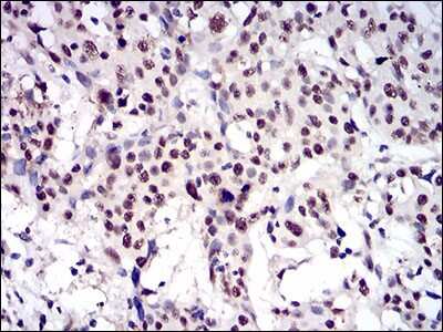 Immunohistochemistry: CTNNBL1 Antibody (1E4F5) - BSA Free [NBP2-37252]