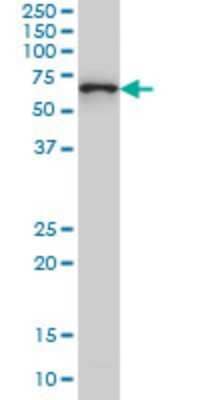 Western Blot: CTNNBL1 Antibody (5F1) [H00056259-M01]