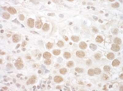 Immunohistochemistry-Paraffin: CTNNBL1 Antibody [NBP1-42679]