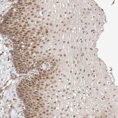 Immunohistochemistry: CTNNBL1 Antibody [NBP1-88298]