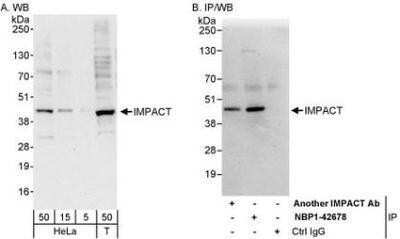 Western Blot: CTNNBL1 Antibody [NBP1-42679]