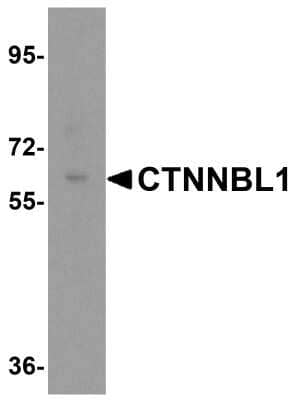 Western Blot: CTNNBL1 AntibodyBSA Free [NBP1-76543]