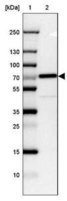 Western Blot: CTNNBL1 Antibody [NBP1-88298]