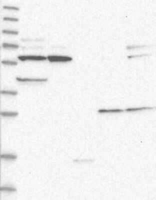 Western Blot: CTNNBL1 Antibody [NBP3-17825]