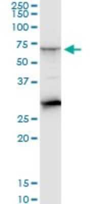 Western Blot: CTNS Antibody (5G6) [H00001497-M09]