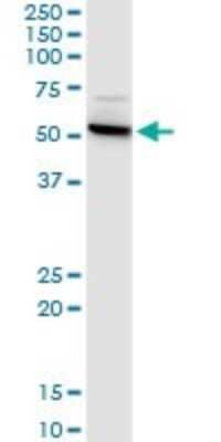 Western Blot: CTNS Antibody (5G6) [H00001497-M09]