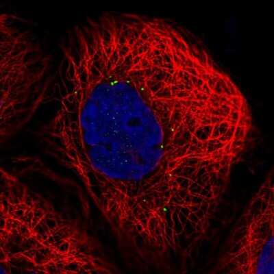 Immunocytochemistry/ Immunofluorescence: CTNS Antibody [NBP2-56839]