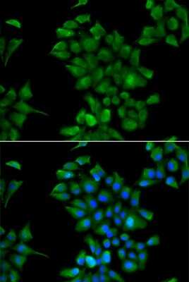Immunocytochemistry/ Immunofluorescence: CTNS Antibody - BSA Free [NBP3-04418]