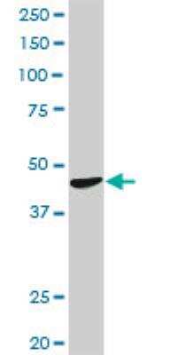 Western Blot: CTNS Antibody [H00001497-D01P]