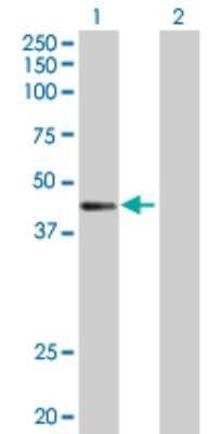 Western Blot: CTNS Antibody [H00001497-D01P]