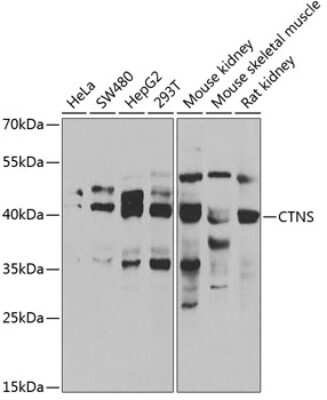 Western Blot: CTNS AntibodyBSA Free [NBP3-04418]