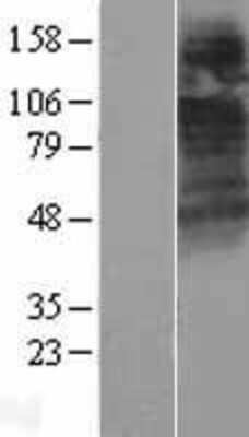 Western Blot: CTNS Overexpression Lysate [NBL1-09579]