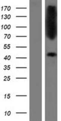 Western Blot: CTNS Overexpression Lysate [NBP2-09811]