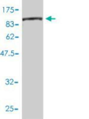 Western Blot: CTP synthase Antibody (2G7-1D10) [H00001503-M01]