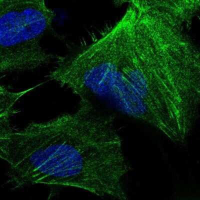 Immunocytochemistry/ Immunofluorescence: CTP synthase Antibody [NBP2-57099]