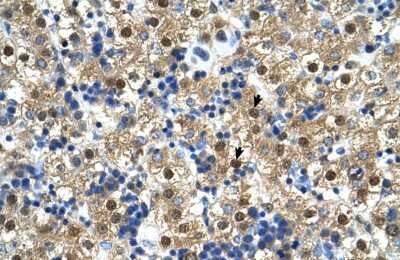 Immunohistochemistry-Paraffin: CTP synthase Antibody [NBP1-52892]