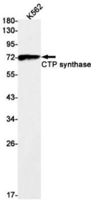 Western Blot: CTP synthase Antibody (S01-9E5) [NBP3-19612]