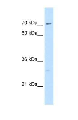 Western Blot: CTP synthase Antibody [NBP1-52892]