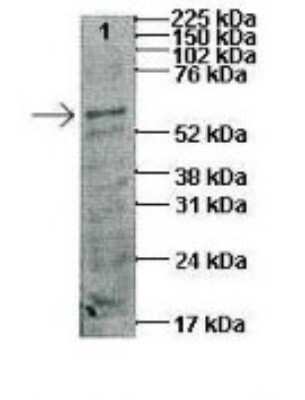 Western Blot: CTP synthase Antibody [NBP1-52892]