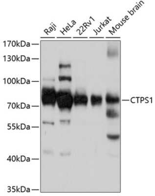 Western Blot: CTP synthase AntibodyAzide and BSA Free [NBP2-92435]