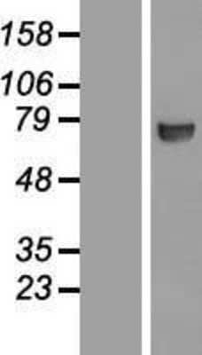 Western Blot: CTP synthase Overexpression Lysate [NBL1-09580]