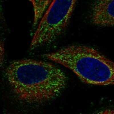 Immunocytochemistry/ Immunofluorescence: CTPS2 Antibody [NBP3-17826]