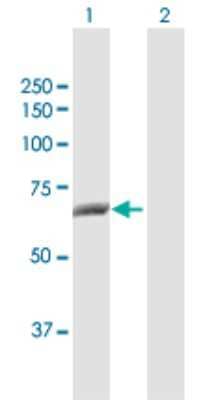 Western Blot: CTPS2 Antibody [H00056474-D01P]