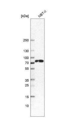 Western Blot: CTPS2 Antibody [NBP1-86055]