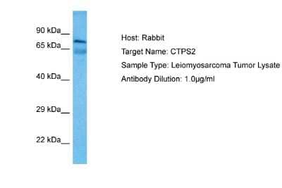 Western Blot: CTPS2 Antibody [NBP2-84732]