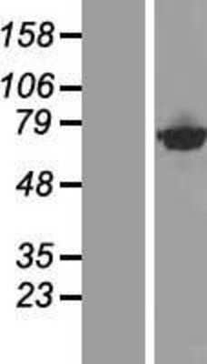 Western Blot: CTPS2 Overexpression Lysate [NBP2-09894]