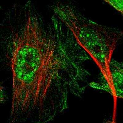 Immunocytochemistry/ Immunofluorescence: CTR2 Antibody [NBP1-85512]