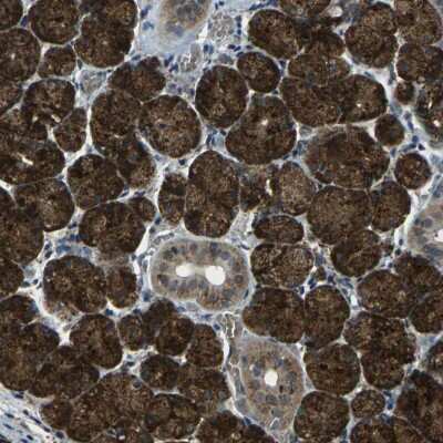 Immunohistochemistry-Paraffin: CTR2 Antibody [NBP1-85512]