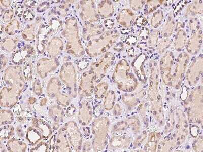 Immunohistochemistry-Paraffin: CTR2 Antibody [NBP2-97266]